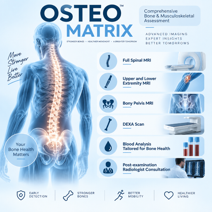 Osteo Matrix